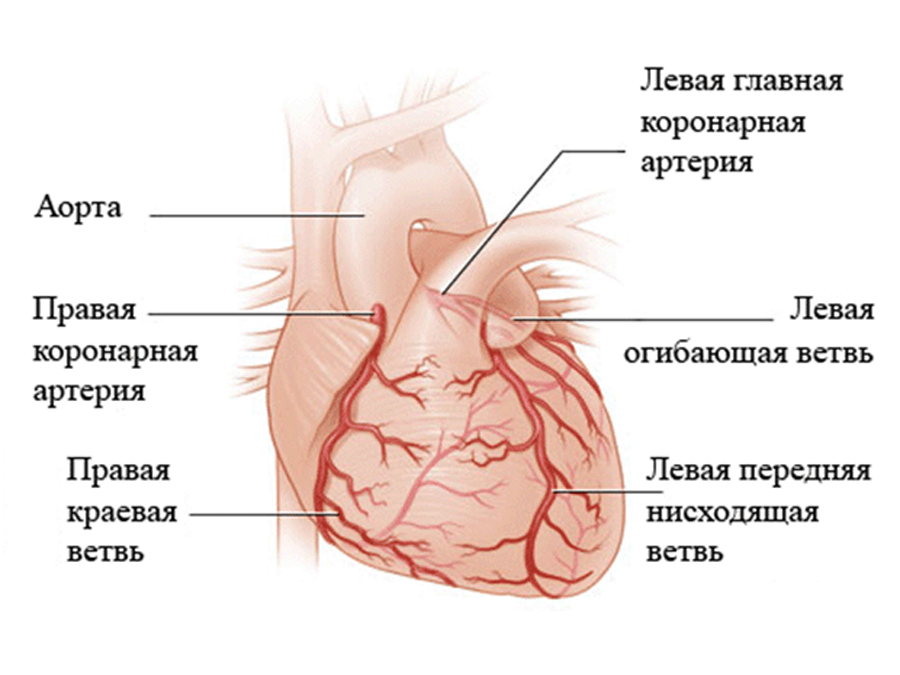 Липидограммы плазмы крови у больных коронарной болезнью сердца